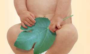 Возможность лечения фимоза в домашних условиях