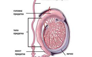 Что представляет собой эпидидимит: лечение народными средствами