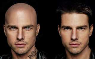 Что делать мужчинам, чтобы волосы не выпадали?