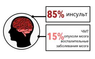 Внезапное нарушение речи или афазия