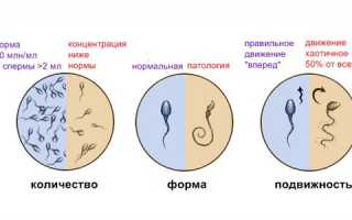 Как работают препараты, улучшающие качество спермограммы?