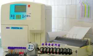 Какой должна быть нормальная спермограмма?