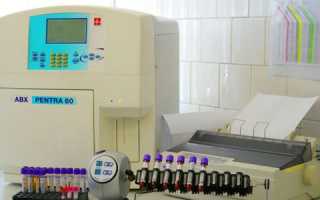 Какой должна быть нормальная спермограмма?