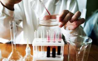 Подготовка к сдаче анализа ПСА