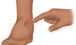 Почему отекают ноги у некоторых мужчин?