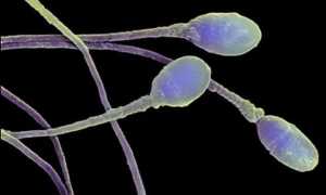 Выявление причин бесплодия с помощью расширенной спермограммы