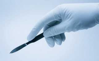 Что такое обрезание?