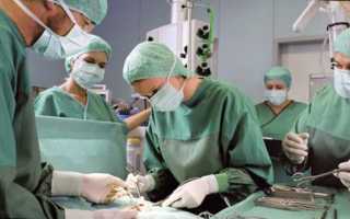 Что такое эмболизация варикоцеле?