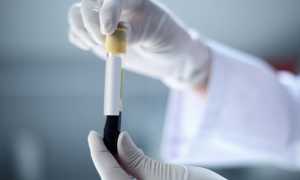 На что влияет ГСПГ у мужчин?