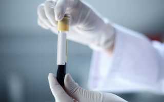 На что влияет ГСПГ у мужчин?