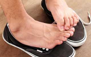 Причины повышенной потливости стоп