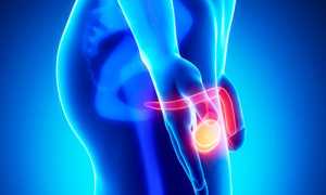 Мужской орхит и эпидидимит