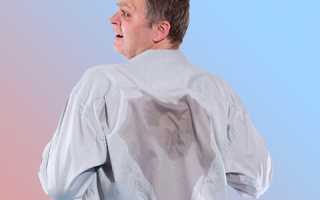 Эффективное лечение гипергидроза в домашних условиях