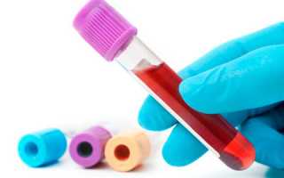 Какая должна быть норма СОЭ в крови у мужчин?