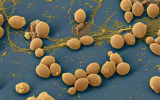 Причины и признаки молочницы у мужчин