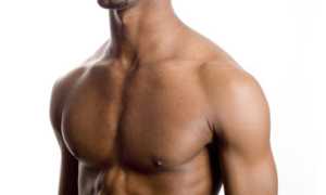 Как возникает шишка на грудине у мужчин?