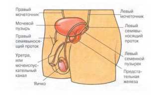 Симптомы и лечение баланита и баланопостита
