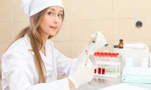 Причины повышения в крови уровня общего ПСА и свободного ПСА