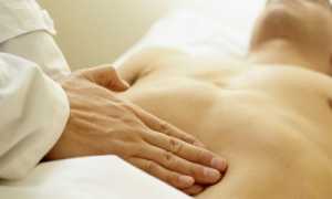 Что представляет собой парапроктит у мужчин