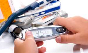 Глюкоза в крови: норма у мужчин