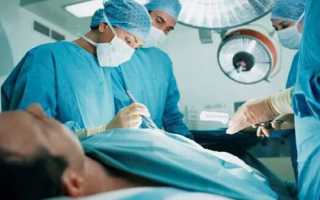 Как имплантируется протез яичка?