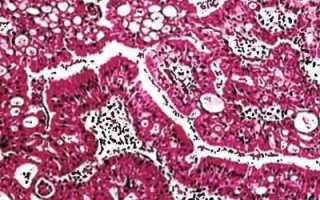 Появление папилломы на половом члене