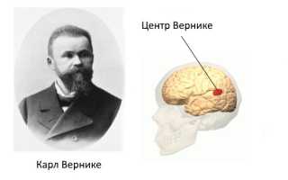 Самое важное о сенсорной афазии