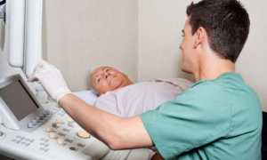 Эпидидимоорхит: основы его диагностики и лечения