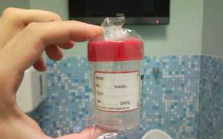 Почему в спермограмме появляется слизь?