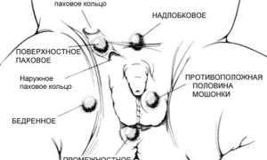 Может ли иметь детей мужчина с одним яичком: ответы экспертов