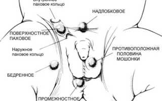 Может ли иметь детей мужчина с одним яичком: ответы экспертов