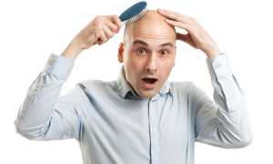 Лечение и профилактика облысения