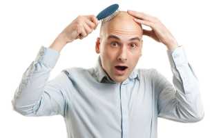 Лечение и профилактика облысения