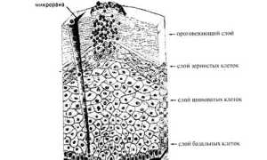 Как лечить ВПЧ у мужчин