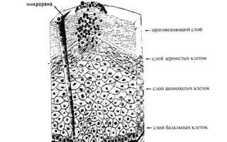 Как лечить ВПЧ у мужчин