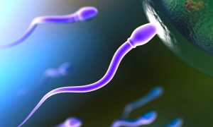 Олигоастенозооспермия: симптомы и лечение