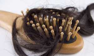 Каковы причины выпадения волос у мужчин в раннем возрасте?