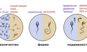 Как и что нужно лечить, если спермограмма плохая?