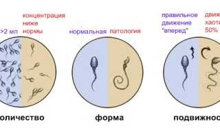 Как и что нужно лечить, если спермограмма плохая?