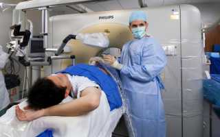 МРТ малого таза у мужчин: выявление труднораспознаваемых заболеваний