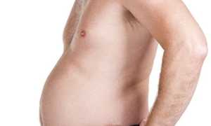 Водянка: симптомы и методы лечения