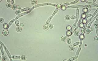 Способы лечения Candida albicans у мужчин