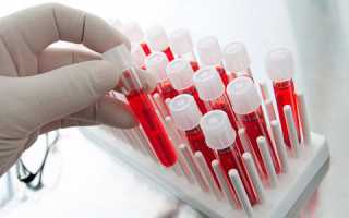 Как можно определить РОЭ в крови: норма у мужчин
