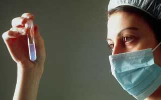 Спермограмма: полная информация об анализе