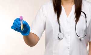 Какие анализы нужно сдать мужчине на наличие в организме инфекции?