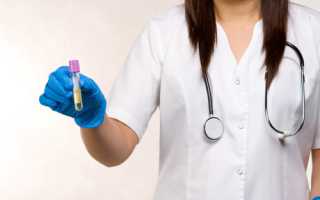 Какие анализы нужно сдать мужчине на наличие в организме инфекции?