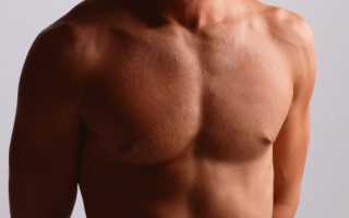 Когда необходимо удаление молочных желез у мужчин?