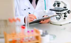 В каких случаях назначается спермограмма по Крюгеру?