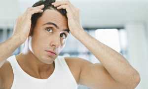 Выпадение волос: причины облысения мужчин и женщин