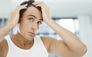 Выпадение волос: причины облысения мужчин и женщин